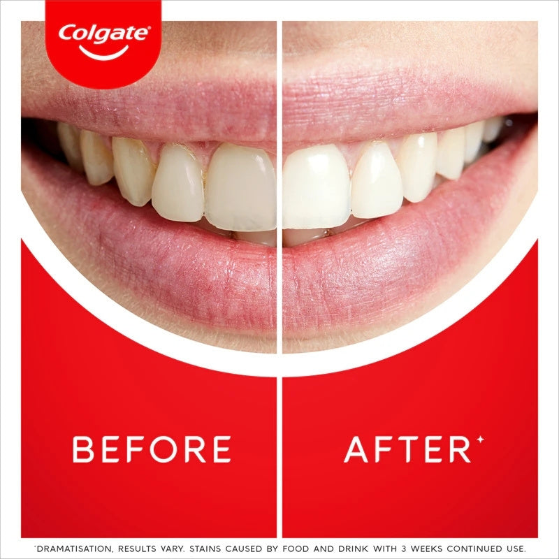 Pastă de dinți COLGATE Max White ULTRA, 50 ml